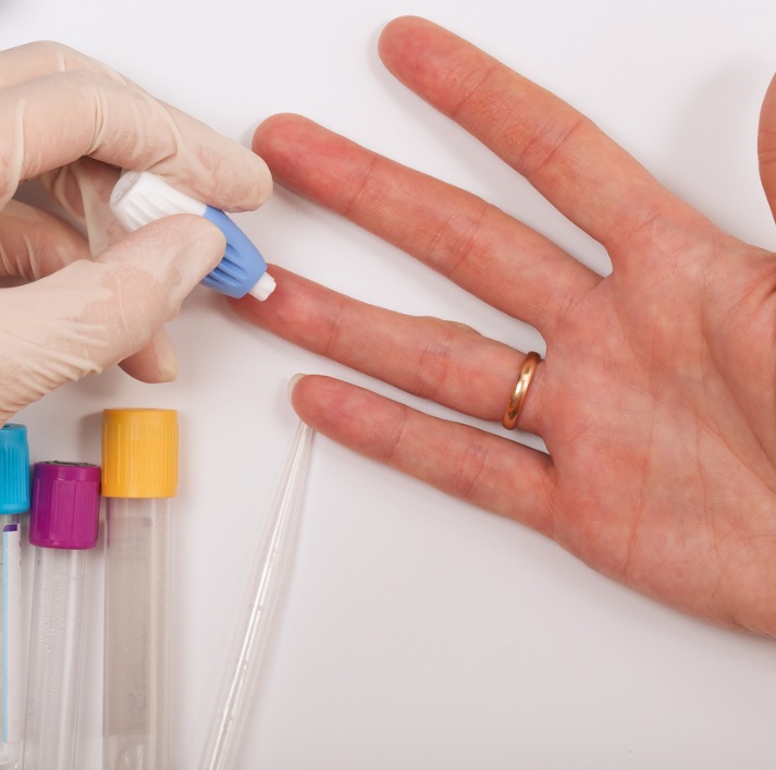 Urban TRT UK testosterone clinic finger prick blood test