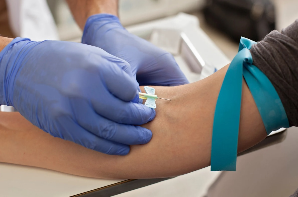 Venous blood test Urban TRT testosterone level blood testing