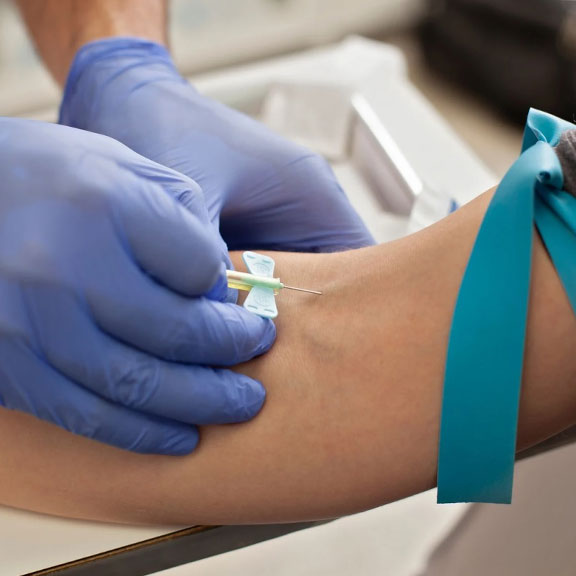 Blood Test 2 - Full Male Hormone Blood Test