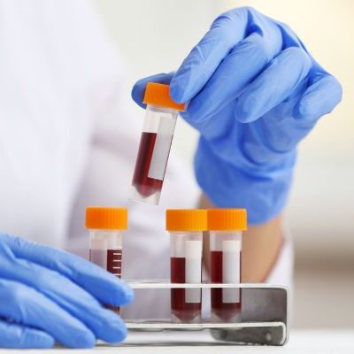 Urban TRT Gibraltar Male Hormone Blood Testing - scientist working with blood samples in lab